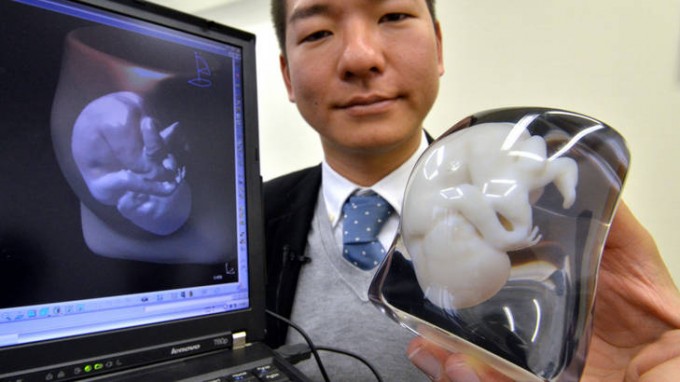 Japan's 3D computer-aided design (CAD) venture Fasotec employee Tomohiro Kinoshita displaying a nine-month fetus and mother's body image, made of two-colour acrylic resin.