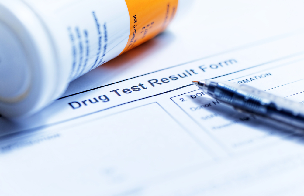 drug-tests-on-cannabinoids (4)